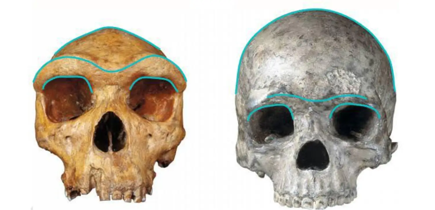 Brow Ridge of Skull.jpeg