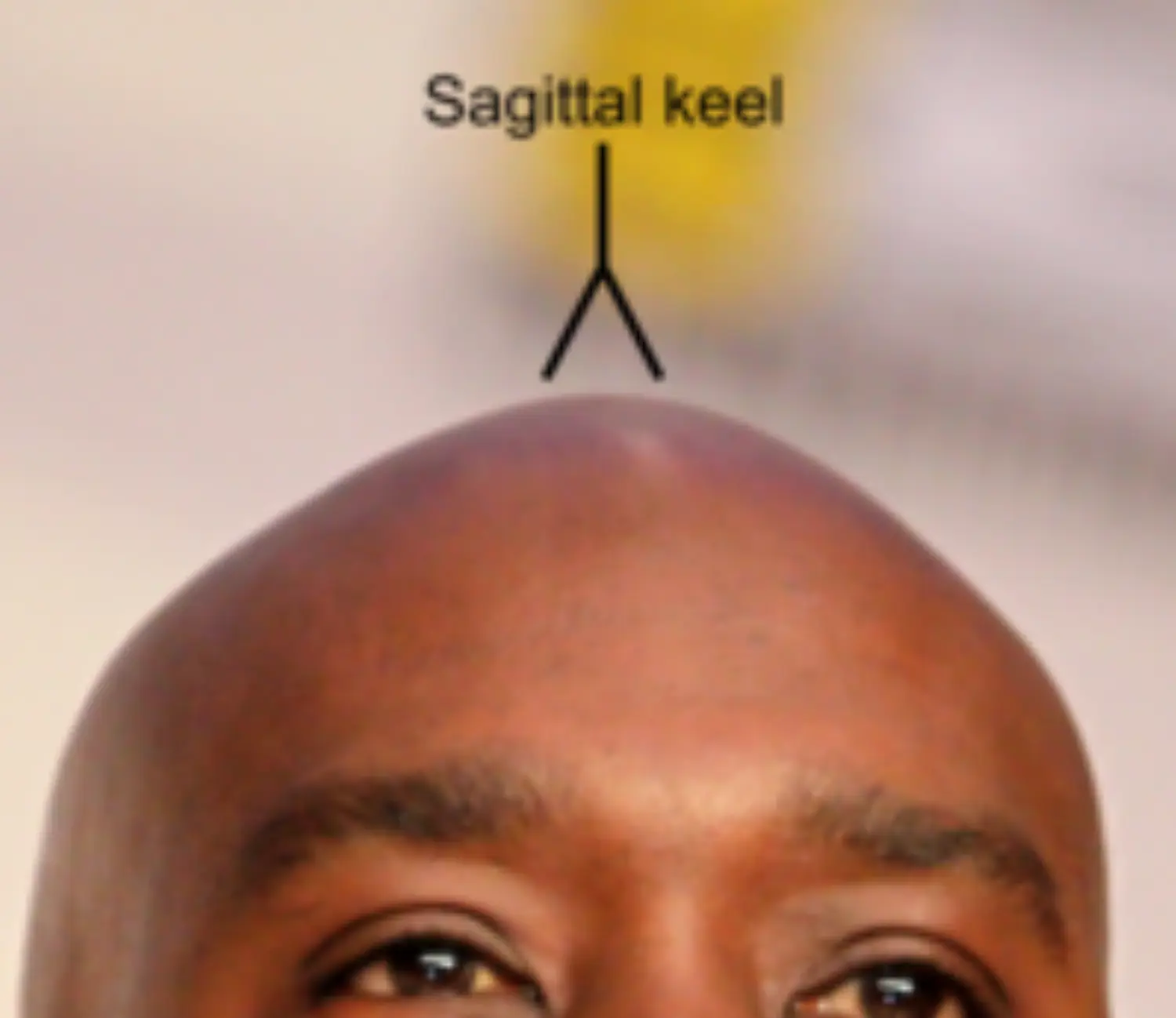 Saggital Keel 2.png