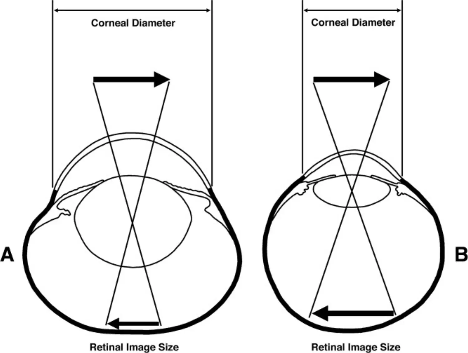 Orbital Convergence of Eye - Result.jpeg