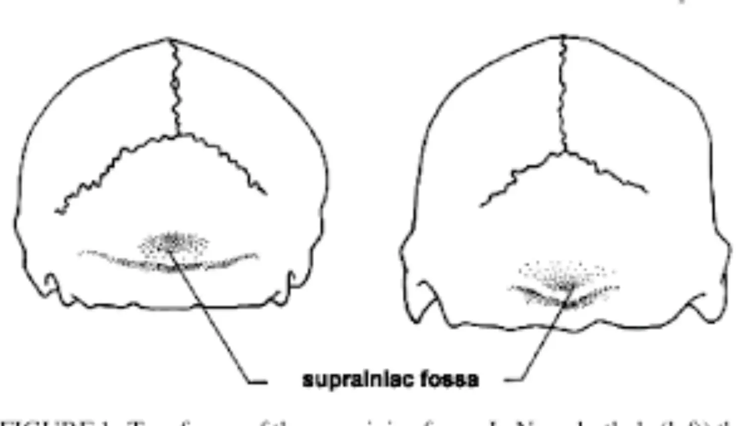 Suprainiac Fossa.png